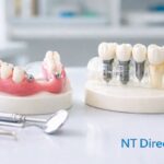 Hawley Retainers Guide: Price, Upper & Lower Types, Cleaning Tips